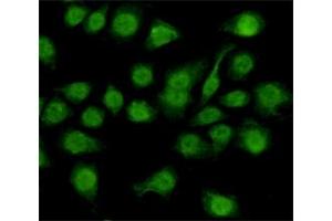 Immunocytochemistry staining of HeLa cells fixed with 4 % Paraformaldehyde and using anti-NFIC mouse mAb (dilution 1:200). (NFIC 抗体)