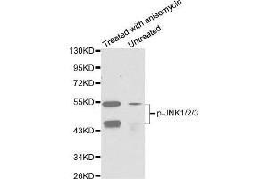 Western blot analysis of extracts from C6 cells untreated or treated with anisomycin using Phospho-MAPK8/9/10-T183/Y185 Antibody. (MAPK8/9/10 抗体  (pThr221, pTyr223))