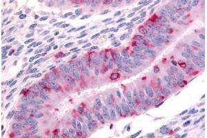 Human Uterus (formalin-fixed, paraffin-embedded) stained with DPP8 antibody ABIN213565 at 20 ug/ml followed by biotinylated goat anti-rabbit IgG secondary antibody ABIN481713, alkaline phosphatase-streptavidin and chromogen. (DPP8 抗体  (N-Term))
