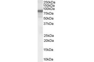 Image no. 3 for anti-Vav 3 Oncogene (VAV3) (Internal Region) antibody (ABIN185278)