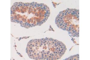 Immunohistochemistry (IHC) image for anti-Carbonyl Reductase 1 (CBR1) (AA 2-271) antibody (ABIN5013289)