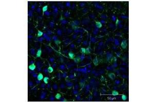 Immunofluorescence Microscopy of GFP-GOAT-Antibody. (GFP 抗体  (FITC))