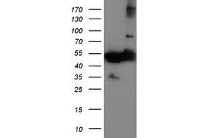 Western Blotting (WB) image for anti-Tubulin, alpha-Like 3 (TUBAL3) (AA 150-446) antibody (ABIN1490957)