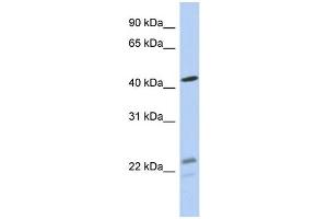 WB Suggested Anti-BCKDHA Antibody Titration: 0. (BCKDHA 抗体  (N-Term))