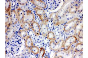 Immunohistochemistry (IHC) image for anti-Solute Carrier Family 22 (Organic Cation Transporter), Member 2 (SLC22A2) (AA 524-555), (Middle Region) antibody (ABIN3043926)