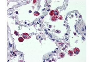 IHC Information: Lung, Human: Formalin-Fixed, Paraffin-Embedded (FFPE) (CYBB 抗体  (C-Term))