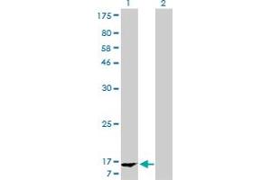 Western Blot analysis of FABP1 expression in transfected 293T cell line by FABP1 monoclonal antibody (M02), clone 5F7. (FABP1 抗体  (AA 1-127))