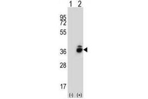 Western blot analysis of CRHBP (arrow) using rabbit polyclonal CRHBP Antibody (N-term) . (CRHBP 抗体  (N-Term))