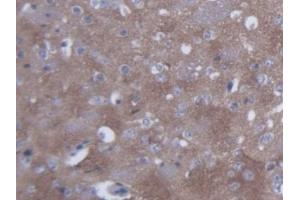 DAB staining on IHC-P; Samples: Mouse Cerebrum Tissue (SYN2 抗体  (AA 88-422))