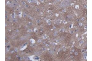 DAB staining on IHC-P; Samples: Mouse Cerebrum Tissue (SYN2 抗体  (AA 88-422))