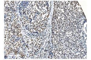 IHC analysis of NRF1 using anti-NRF1 antibody (ABIN7600874).