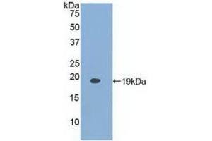 Detection of Recombinant FABP9, Human using Polyclonal Antibody to Fatty Acid Binding Protein 9, Testis (FABP9) (FABP9 抗体  (AA 1-132))