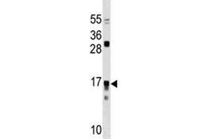 IL17RC antibody western blot analysis in Jurkat lysate. (IL17RC 抗体  (AA 103-131))