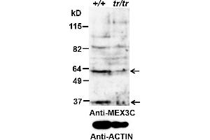 ABIN2563852 (0. (MEX3C 抗体  (AA 541-554))
