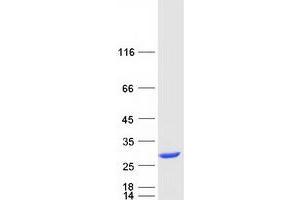 Western Blotting (WB) image for Prefoldin Subunit 3 (PFDN3) protein (Myc-DYKDDDDK Tag) (ABIN2712343)