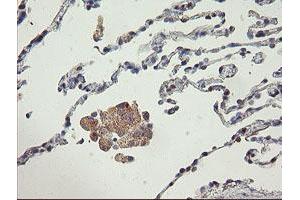 Immunohistochemistry (IHC) image for anti-ATP/GTP Binding Protein 1 (AGTPBP1) (AA 368-753) antibody (ABIN1491460) (AGTPBP1 抗体  (AA 368-753))