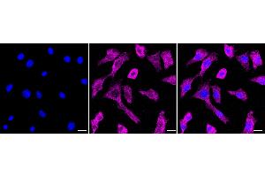 Immunocytochemical staining of HepG2 cells with DNAJA4 antibody (ABIN7798373), 1:1,000). (Recombinant DNAJA4 抗体)