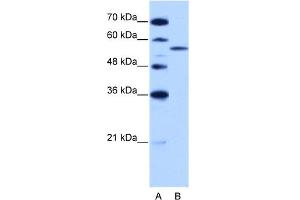 Western Blotting (WB) image for anti-Zinc Finger (CCCH Type), RNA-Binding Motif and serine/arginine Rich 2 (ZRSR2) (C-Term) antibody (ABIN2778926)
