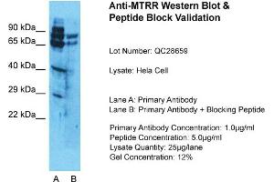 Host: Rabbit  Target Name: MTRR  Sample Tissue: HelaLane A:  Primary Antibody Lane B:  Primary Antibody + Blocking Peptide Primary Antibody Concentration: 1 µg/mL Peptide Concentration: 5. (MTRR 抗体  (N-Term))