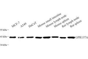 Western blot analysis of GPR137A (ABIN7073996) at dilution of 1: 500 (GPR137 抗体)