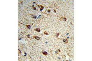 Formalin-fixed and paraffin-embedded human brain tissue reacted with Fibromodulin Antibody (C-term) followed which was peroxidase-conjugated to the secondary antibody, followed by DAB staining. (Fibromodulin 抗体  (C-Term))