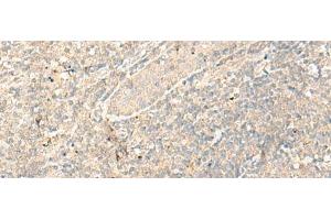 Immunohistochemistry of paraffin-embedded Human tonsil tissue using RGR Polyclonal Antibody at dilution of 1:25(x200) (RGR 抗体)