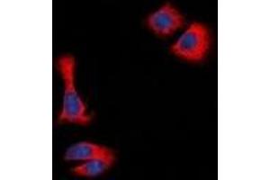 Immunofluorescent analysis of STMN1 staining in Hela cells. (Stathmin 1 抗体  (N-Term))