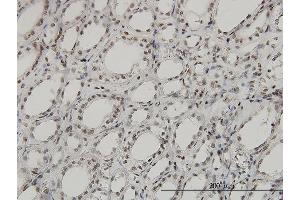 Immunoperoxidase of monoclonal antibody to SGK on formalin-fixed paraffin-embedded human kidney. (SGK1 抗体  (AA 1-431))