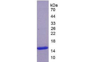 SDS-PAGE analysis of Human ADAMTS7 Protein. (ADAMTS7 蛋白)