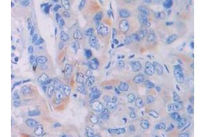Used in DAB staining on fromalin fixed paraffin- embedded liver tissue (LGALS9B 抗体  (AA 17-148))