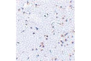 Immunohistochemistry of TSLP in human brain tissue with TSLP polyclonal antibody  at 2. (Thymic Stromal Lymphopoietin 抗体  (C-Term))