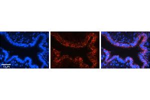 Immunohistochemistry (IHC) image for anti-Voltage-Dependent Anion Channel 2 (VDAC2) (N-Term) antibody (ABIN2776154)
