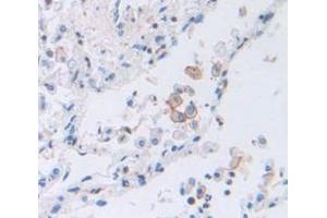IHC-P analysis of Human Tissue, with DAB staining. (PTGER2 抗体  (AA 155-355))