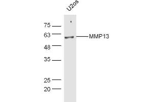 Human U2os lysates probed with Rabbit Anti-MMP13 Polyclonal Antibody, Unconjugated  at 1:5000 for 90 min at 37˚C.
