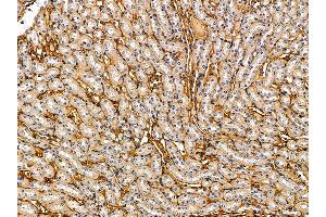 ABIN7095773 and ABIN7099835 at 1/100 staining rat liver tissue by IHC-P. (EMP3 抗体)