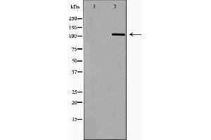 Western blot analysis of Hela whole cell lysates, using OGT Antibody. (OGT 抗体  (N-Term))