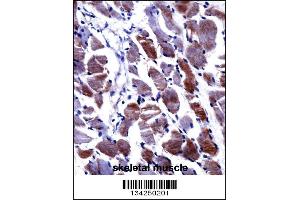DPYSL3 Antibody immunohistochemistry analysis in formalin fixed and paraffin embedded human skeletal muscle followed by peroxidase conjugation of the secondary antibody and DAB staining. (DPYSL3 抗体  (C-Term))