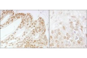 Immunohistochemistry (IHC) image for anti-COP9 Constitutive Photomorphogenic Homolog Subunit 5 (Arabidopsis) (COPS5) (AA 175-225) antibody (ABIN7449381)