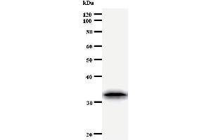 Western Blotting (WB) image for anti-Twist Homolog 1 (Drosophila) (TWIST1) antibody (ABIN933111) (TWIST1 抗体)