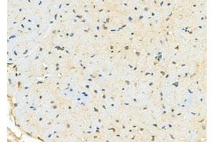ABIN6264663 and ABIN6278106 at 1/100 staining Mouse heart tissue by IHC-P.