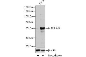 Western blot analysis of extracts of HT-29 cells using Phospho-p53(S33) Polyclonal Antibody at dilution of 1:2000. (p53 抗体  (pSer33))