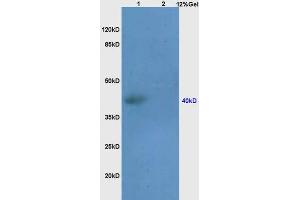 Lane 1: human colon carcinoma lysates Lane 2: mouse thymus lysates probed with Anti SEPT1 Polyclonal Antibody, Unconjugated (ABIN872796) at 1:200 in 4 °C. (Septin 1 抗体  (AA 161-260))