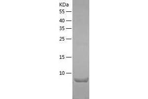 Chemokine (C-C Motif) Ligand 21C (Leucine) (CCL21C) (AA 24-133) protein (His-IF2DI Tag)