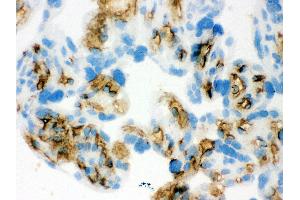 Anti- Band 3 Picoband antibody,IHC(F) IHC(F): Human Placenta Tissue (Band 3/AE1 抗体  (AA 28-365))