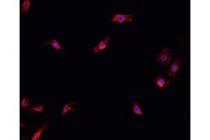 ABIN6266706 staining K-562 cells by IF/ICC. (T-Box 1 抗体  (C-Term))