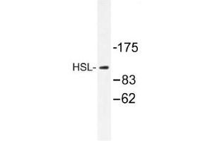 Image no. 1 for anti-Lipase, Hormone-Sensitive (LIPE) antibody (ABIN317711) (LIPE 抗体)