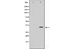 Western Blotting (WB) image for anti-Tumor Necrosis Factor Receptor Superfamily, Member 6b, Decoy (TNFRSF6B) antibody (ABIN6265644)