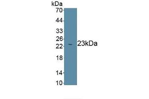 Detection of Recombinant Smad3, Human using Monoclonal Antibody to SMAD family member 3 (SMAD3) (SMAD3 抗体  (AA 231-425))