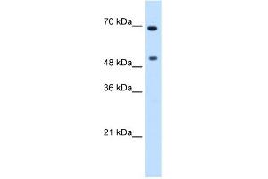 WB Suggested Anti-MYC Antibody Titration:  0. (c-MYC 抗体  (N-Term))