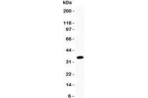 Western blot testing of Cofilin antibody and recombinant human protein (0. (Cofilin 抗体  (AA 2-166))